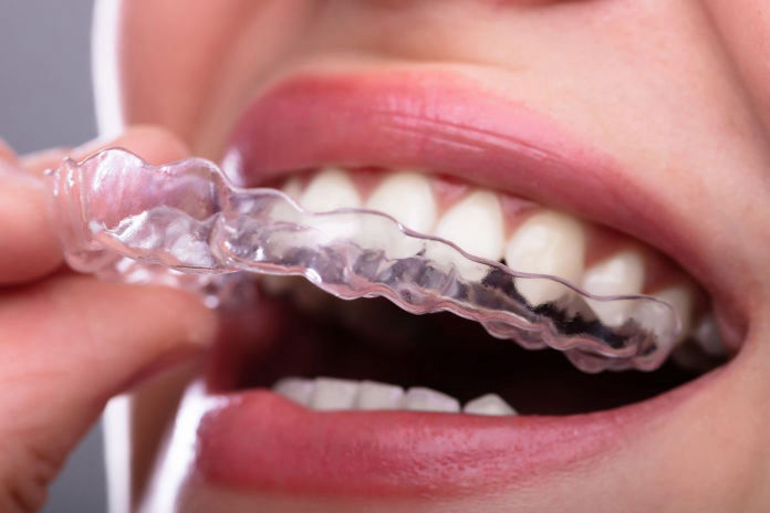 Invisible Braces in Albuquerque NM | Success Smiles Orthodontics