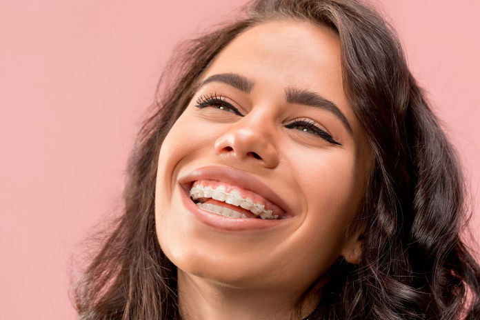 Adult Tooth Colored Braces in Albuquerque NM | Success Smiles Orthodontics